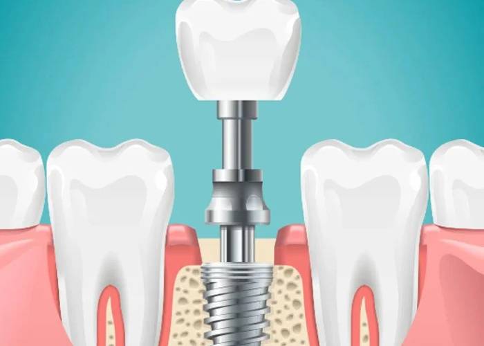 Dr.Madhumita Treatments