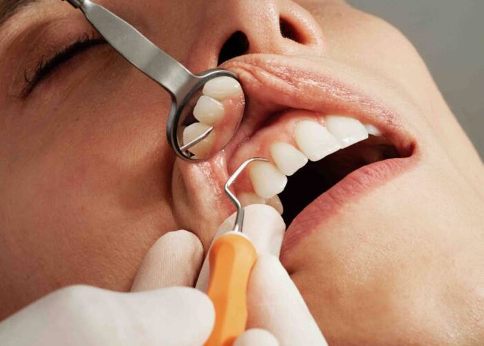 Dr.Madhumita Treatments