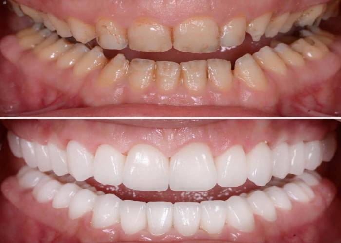 Dr.Madhumita Treatments