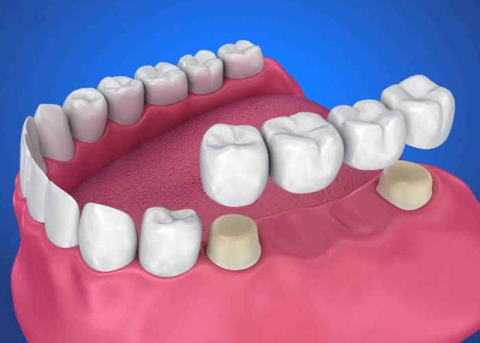 Dr.Madhumita Treatments