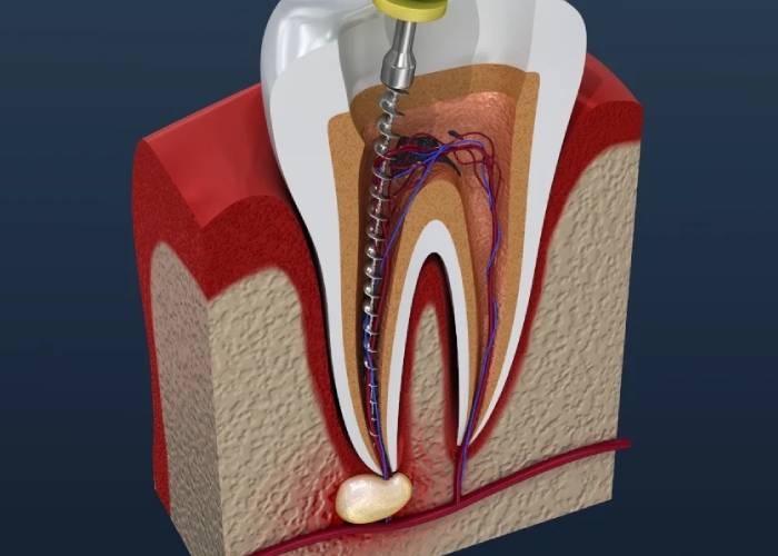 Dr.Madhumita Treatments